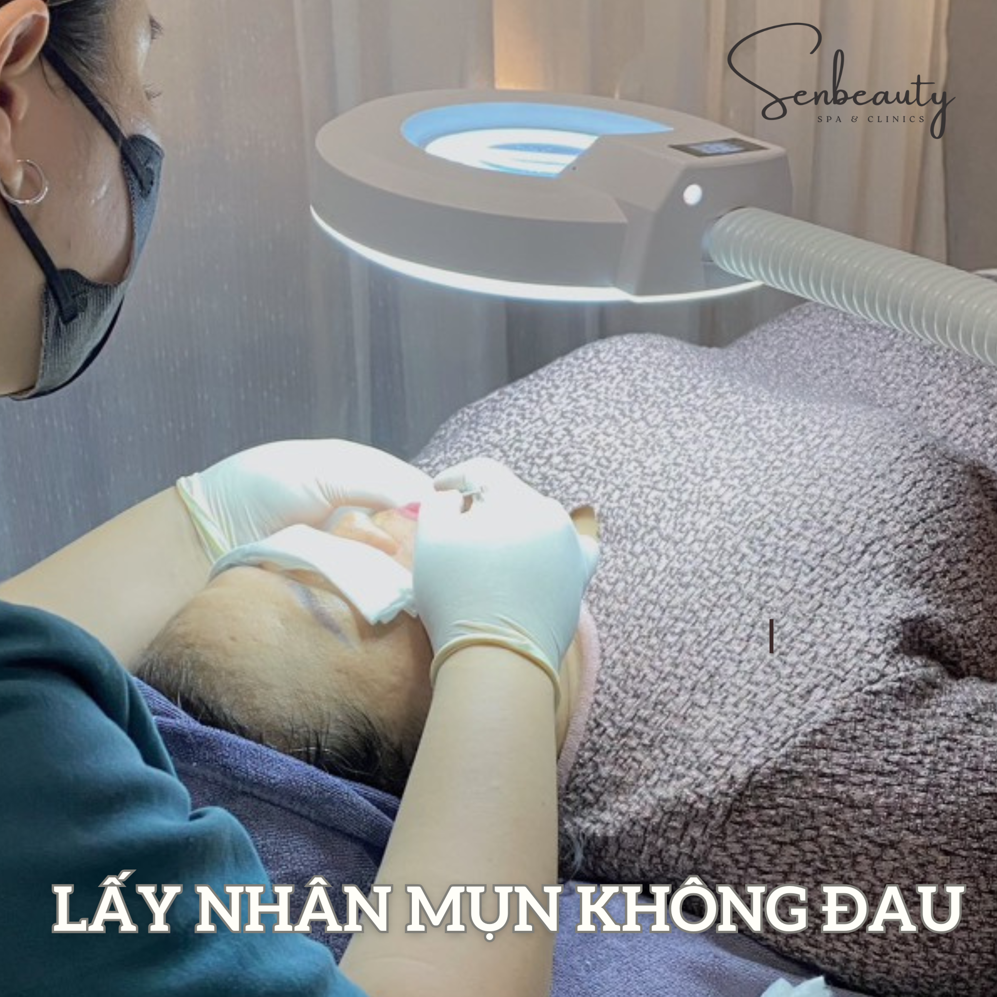 Trị mụn đầu đen hiệu quả